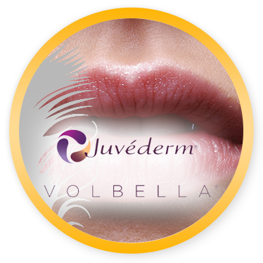 Juvederm-Volbella