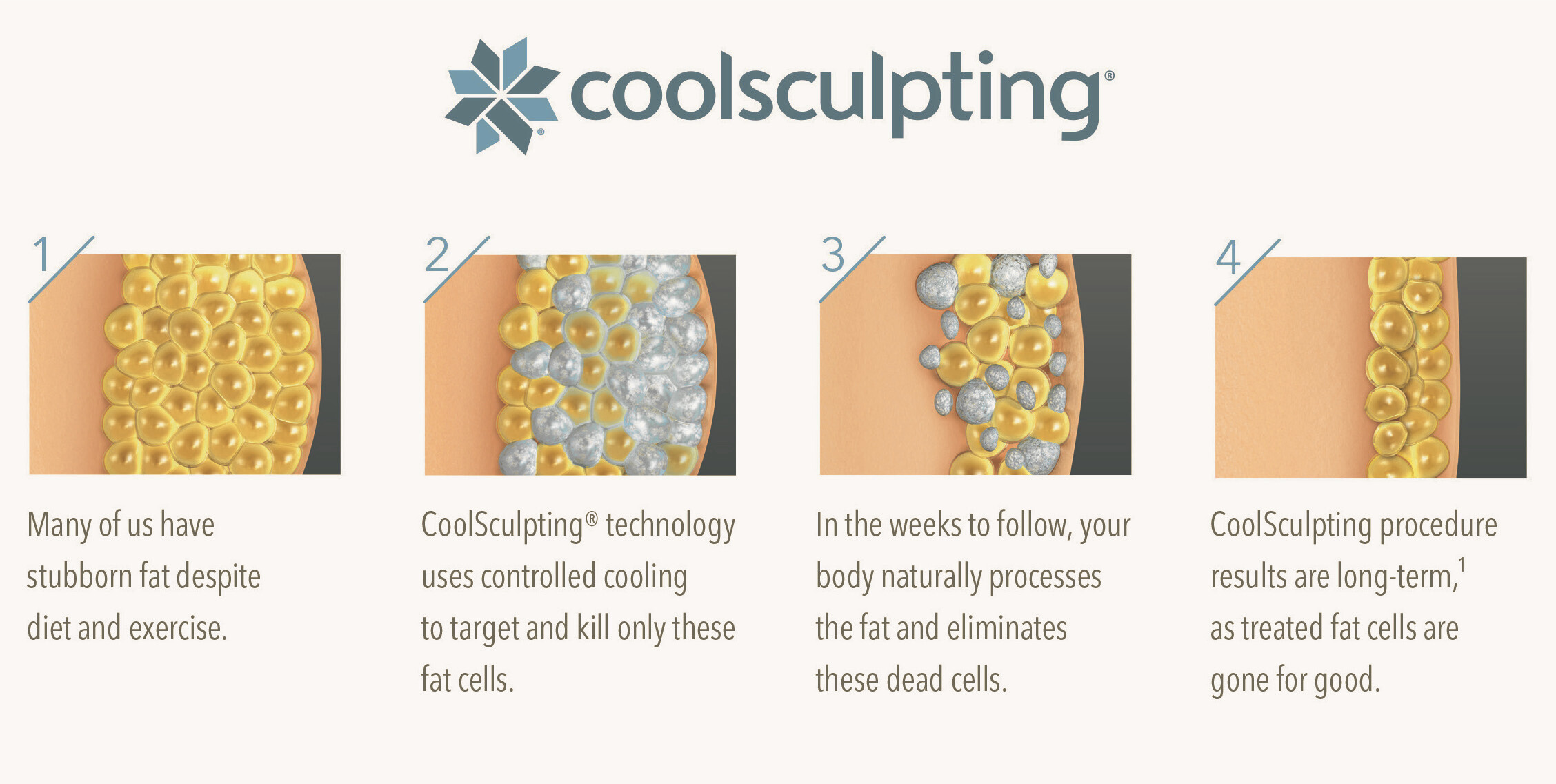 coolsculptinghowitworks Gentle Touch MediSpa